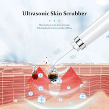 Load image into Gallery viewer, Ultrasonic Skin Scrubber Electric Facial Cleansing